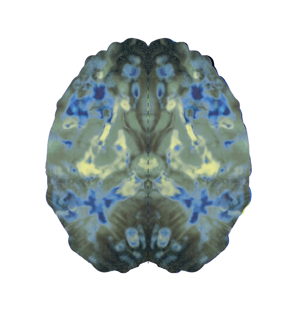 Circadian rhythm brain visualization — how jet lag disrupts your sleep-wake cycle